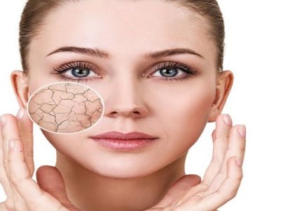 راه های سریع درمان پوست خشک
