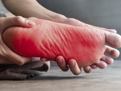 علت داغی کف پا
