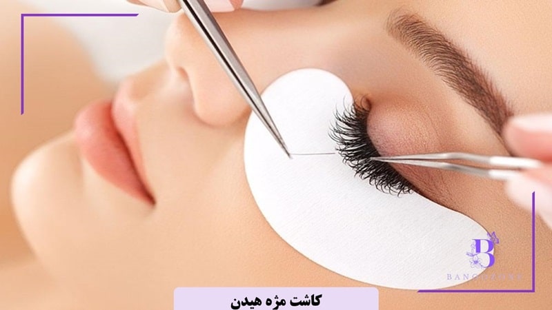 کاشت مژه هیدن