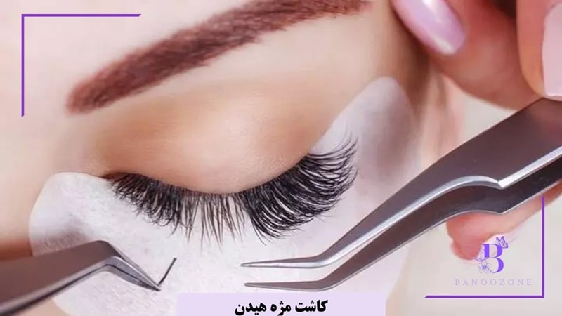 کاشت مژه هیدن
