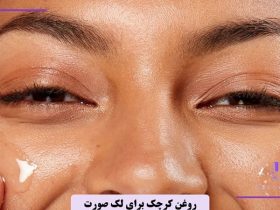روغن کرچک برای لک صورت تا چه زمانی جواب میدهد