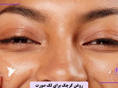 روغن کرچک برای لک صورت تا چه زمانی جواب میدهد