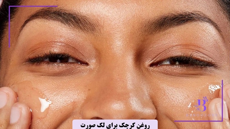 روغن کرچک برای لک صورت تا چه زمانی جواب میدهد