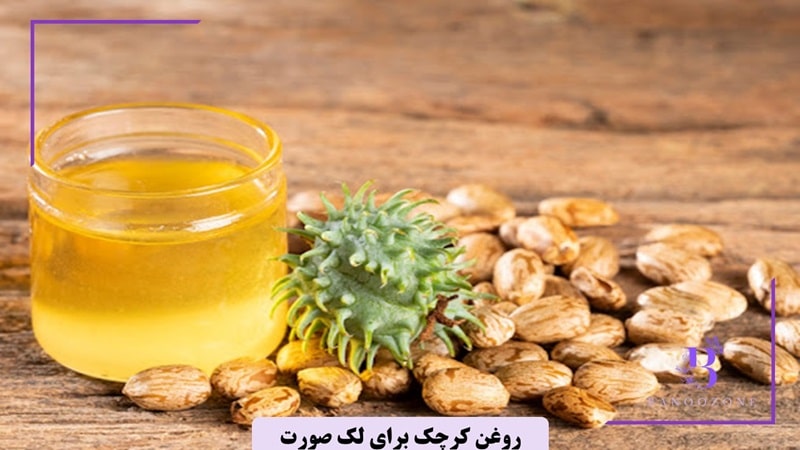 روغن کرچک برای لک صورت تا چه زمانی جواب میدهد