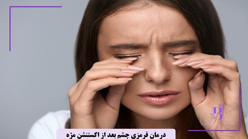 درمان قرمزی چشم بعد از اکستنشن مژه