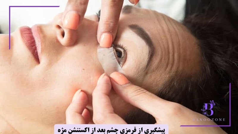 پیشگیری از قرمزی چشم بعد از اکستنشن مژه