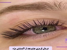 درمان قرمزی چشم بعد از اکستنشن مژه