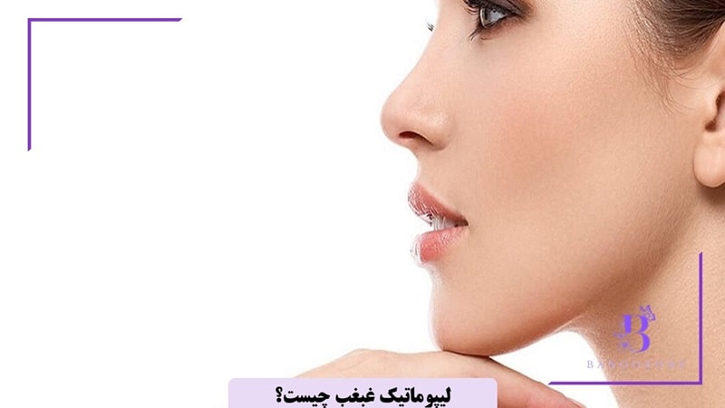 لیپوماتیک غبغب چگونه انجام میشود