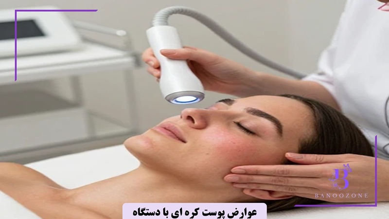 عوارض تکنیک پوست کره‌ ای 